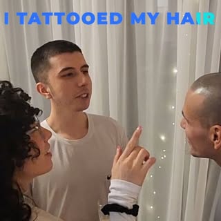 It's been more than 2 years now of my life-changing decision undergoing Scalp Micropigmentation It h