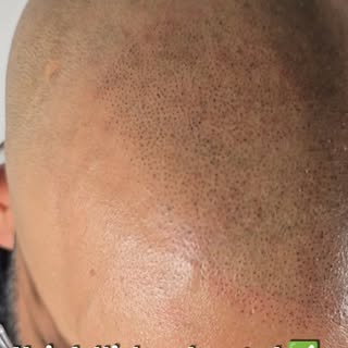 My goal is always to achieve the most realistic result by matching the areas where hair is still pre