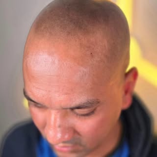 Four months healed, real result. For this client, we went with my darkest blend by request. The goal