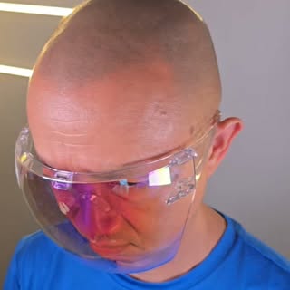 A hairline does more than replace the look of lost hair, it brings back the frame of the face.

This