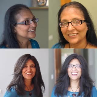 #Chicago’s leading #NonSurgicalHairReplacement #specialists. #NonSurgicalGrafting is, by far, the mo