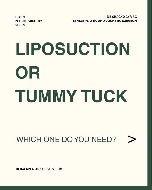 TUMMY TUCK OR LIPOSUCTION?
They are NOT the same surgery.

THE DIFFERENCE

LIPOSUCTION
✔ Removes unw