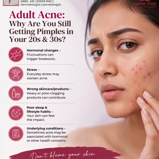 Adult acne in your 20s & 30s is more common than you think! 💆‍♀️ ✨ 
Hormonal changes, stress, skinc