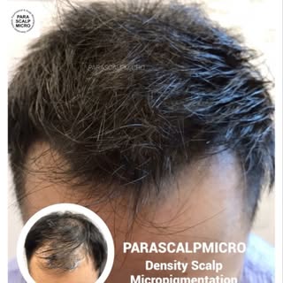 He forgot how he looked like before coming to us. Hair shouldn’t be one of your worries. www.parasca