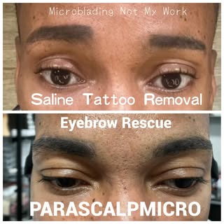 Unfortunately he didn’t do his research to do Microblading. The previous Artist gave him Extreme Une