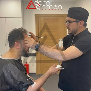 ADEMAĞIRMAN HAİRTRANSPLANT
https://www.ademagirman.com
#saçekimi #sakalekimi #hairtransplant 
#adema