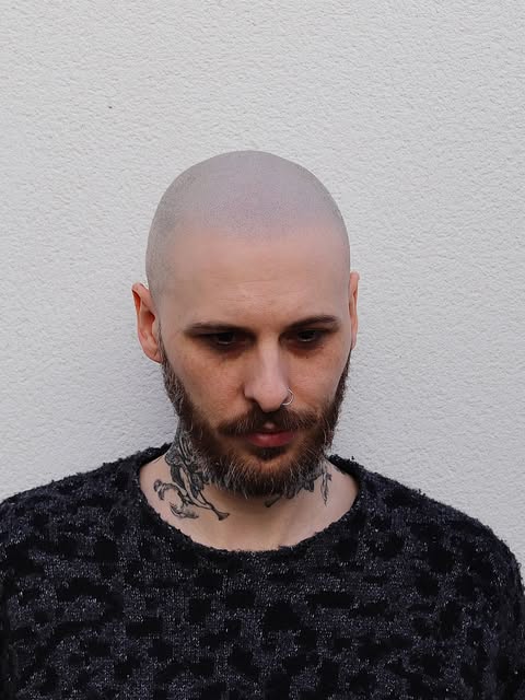 Amazing Scalp MicroPigmentation (SMP) healed results showing off his hair tattoo done by INKonHair C