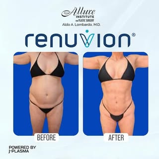 New Year New Body!! Call Dr. Lombardo for a complimentary consultation !! 561-747-1232