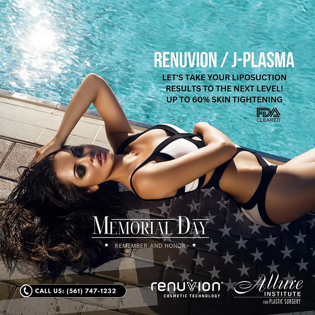 Get your Summer Body with Dr. Lombardo @allureplasticsurgery @renuvionsouthflorida @renuvion 🌞😎👙�
