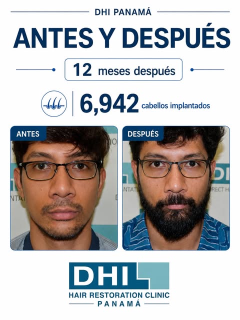 Una barba puede cambiar por completo la percepción del rostro.

Aquí puedes ver el resultado después