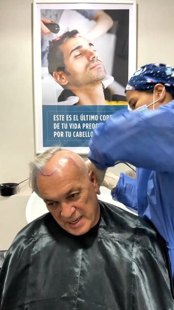 ✨ ¿Cómo se ve un implante capilar DHI después de solo 10 días?

En este testimonio, nuestro paciente
