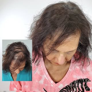 Scalp Micropigmentation for women #scalpmicropigmentation #scalppfem #scalppfemian #houstonhairstyli