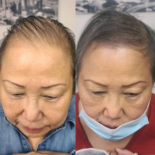 This wonderful lady came to us after chemotherapy had thinned most of her hair. We were definitely a