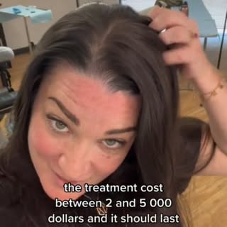Scalp Micropigmentation for Women and Thinning Hair here in Houston, Texas and San Antonio, Texas

T
