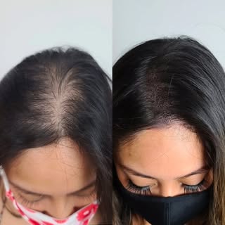 Scalp Micropigmentation for Women Houston Texas

📞 Call or text: 713-588-5852
📧 Email: info@scalpp