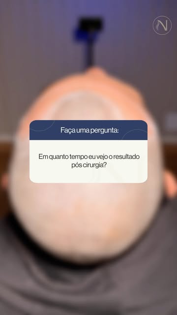 Essa é uma das perguntas que mais aparecem depois do transplante capilar: “Em quanto tempo eu vejo r