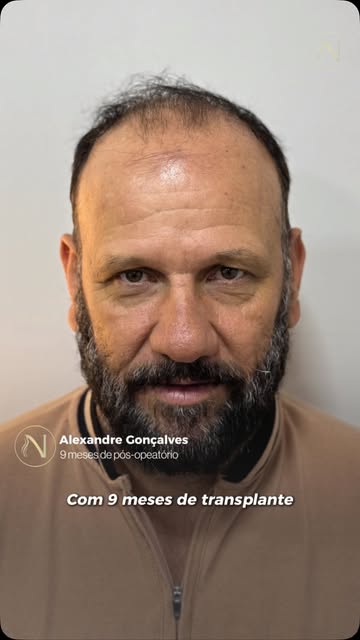 O Boné Deixou de Ser Necessidade. 💙

Casamento, festa, qualquer ocasião: o boné estava sempre prese