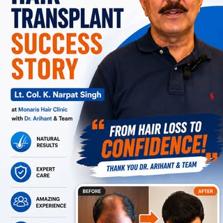 Witness the inspiring hair transplant journey of Lt. Col. K. Narpat Singh at Monaris Hair Clinic.

I