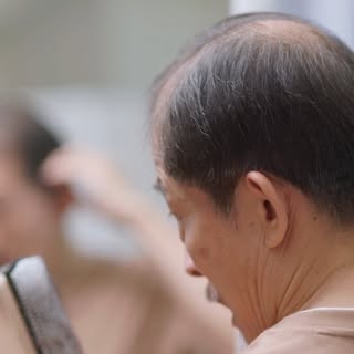 Thinning or balding hair doesn’t have to be something you face alone. At Capilia Orlando, we offer a