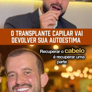 Muitos homens pensam no transplante capilar apenas como uma solução estética.
Mas, na prática, o imp