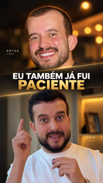 Hoje, eu não conheço a jornada do transplante capilar apenas como médico. Eu também já estive do out
