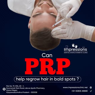 Be it a #HairTransplant #PRP #StemCell
#Balding issues or any other #Hair related problems
Advanced 