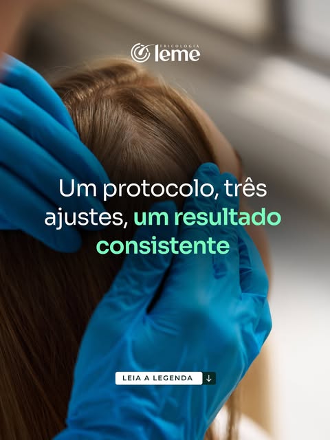 Um protocolo não precisa ser engessado para ser eficiente.

Na tricologia, cada paciente responde de