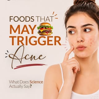 🍔 Does eating your favourite foods really cause acne?

You've probably heard people say,
"Stop eati