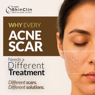 🤔 Why do some acne scars disappear... while others never seem to fade?

Here's what most people don