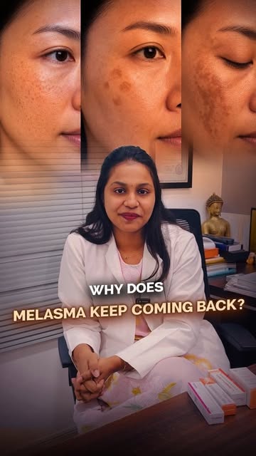 Struggling with melasma and wondering why the pigmentation keeps coming back? 🤔

Melasma can be inf