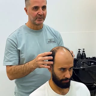 Fresh look, seamless result.
Hair replacement done right. ✂️🔥
