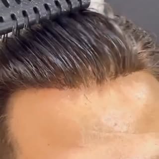 Hair loss doesn’t change who you are. It’s how you choose to show up that does.

Experience a natura