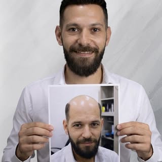 لأن صورتك هي عنوان ثقتك!
بين الأمس واليوم.. خيط رفيع من الاحترافية والجمال. استعد مظهرك وجاذبيتك بلم