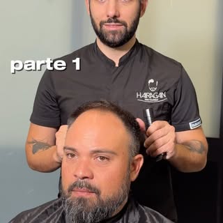 Paolo ha deciso di ritrovare il suo look originale con un impianto capillare Hair Again Light! 

In 
