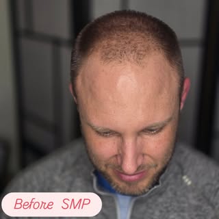 This gentleman wanted a broken, natural hairline with brown tones and a strong appearance. #eddielop