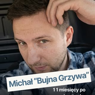 “Pan Michał zakolak już zniknął, teraz jest Michał Bujna Grzywa!”😎🔝

Michał zdecydował się na prze