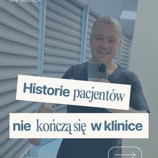 Historie pacjentów nie kończą się w klinice. Zaskakujące? 😉

Przeszczep włosów to nie ostatni, a ra