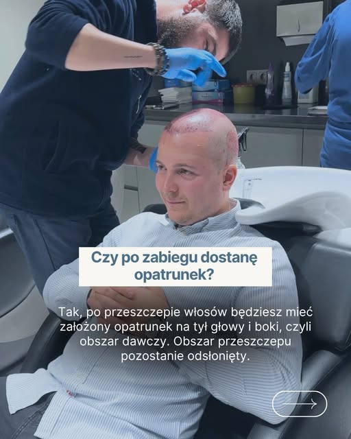 Czy po przeszczepie włosów dostanę opatrunek?

✔ Tak, po przeszczepie włosów będziesz miał założony 