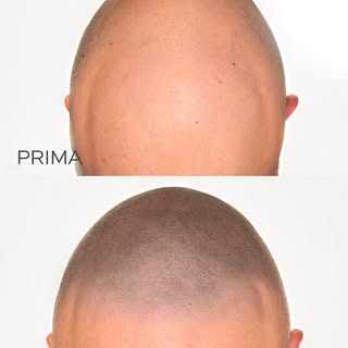 Guarda quello che non si nota.

Quando un risultato è naturale, le persone non pensano:

“Ha fatto u