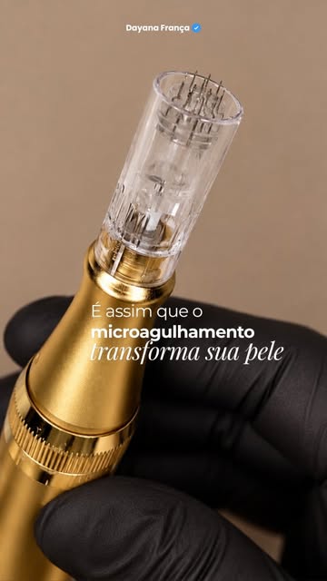 Microagulhamento ativa um processo biológico profundo de regeneração.
Quando as microagulhas penetra
