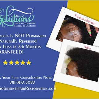 Alopecia is NOT Permanent Reclaim your hair loss in 3-6 Months GUARANTEED🌿🌿🌿

Book your FREE Cons