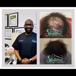 Struggling with Hair Shedding or Thinning Hair? Our holistic hair restoration clinic uses natural th