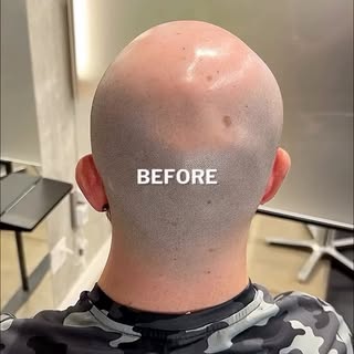Scalp MicroPigmentation (The Cosmetic Hair Tattoo) by Chris Pritchard in Regina, Sk — www.microbarbe