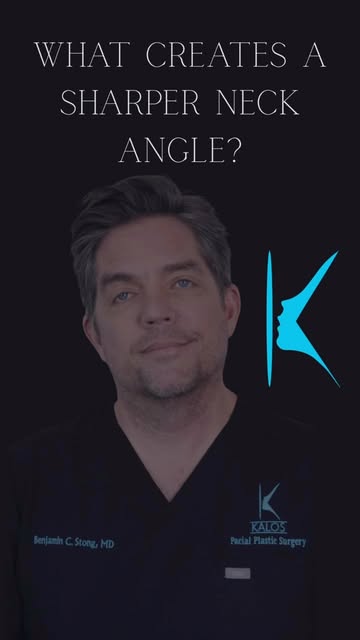 What actually creates a sharper, more defined neck angle during facelift surgery?

For Dr. Stong, it