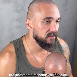 Pós Implante Capilar:
______________________________________
______________________________________

