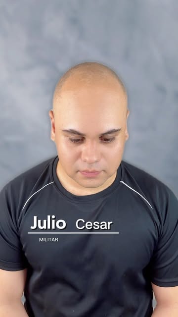 Nano Capilar 4D, Ultra-Realista 🔥

▪️Acabe com a calvície em 15 dias.
📍 Atendimentos no Rio de Jan