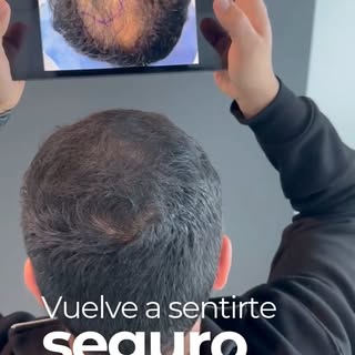 ¿Te imaginas volver a mirarte al espejo y sentirte más seguro que nunca? Con nuestros procedimientos