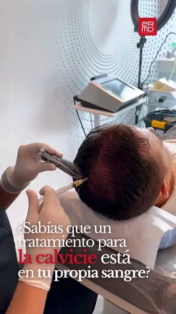 Plasma Rico en Plaquetas (PRP): aliado en el tratamiento capilar

¿Sabías que tu propia sangre puede