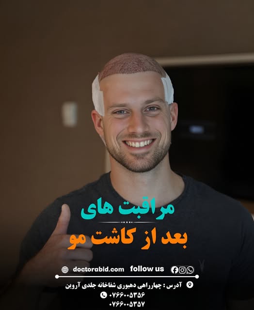 توصیه‌های مهم بعد از کاشت مو

بعد از کاشت مو، رعایت مراقبت‌های لازم برای حفاظت از موهای کاشته‌شده و 