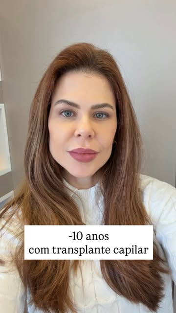 A falta de cabelo pode estar colocando anos na sua aparência.

Você tem 50. Não precisa parecer ter 